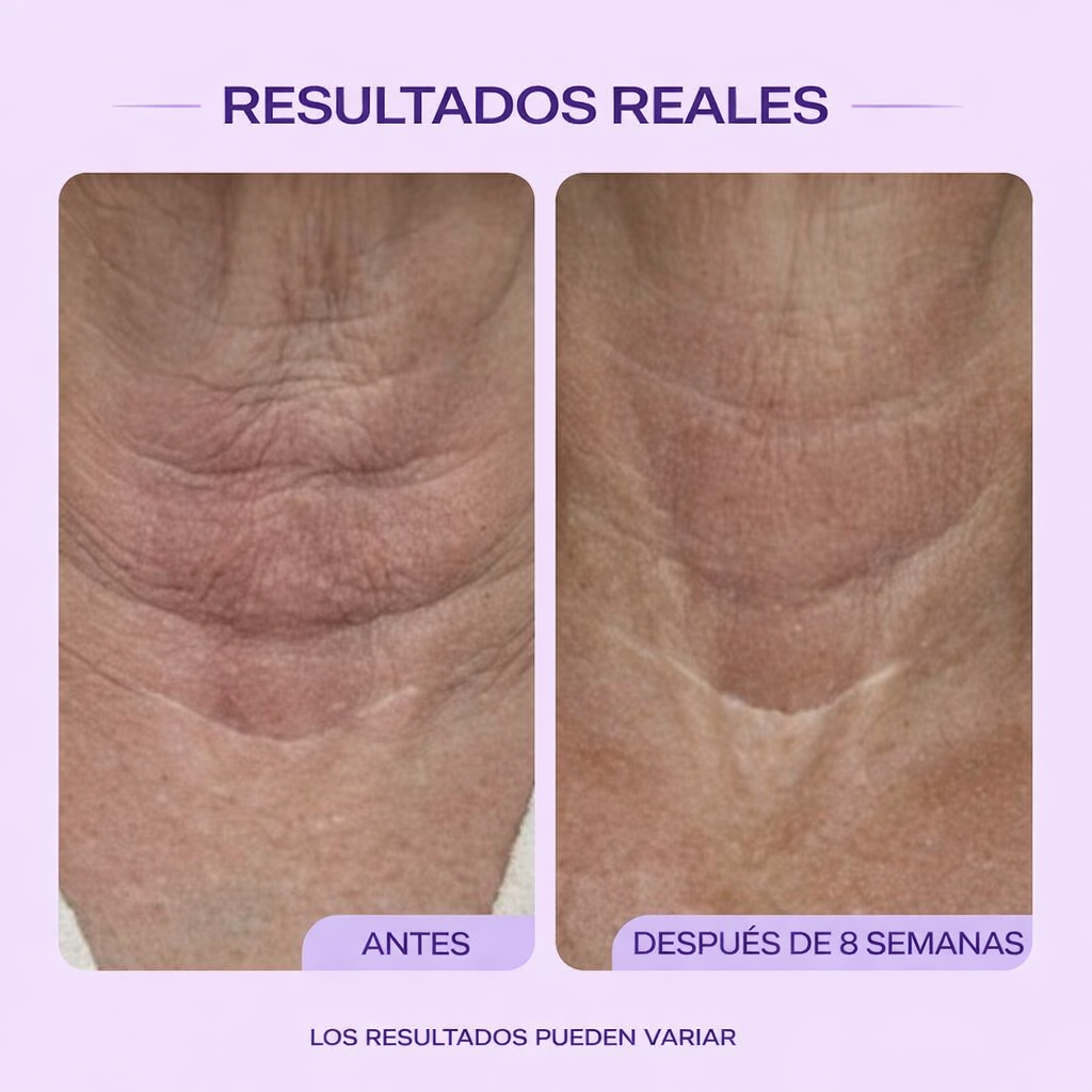 ESSOR® Sérum Reafirmante