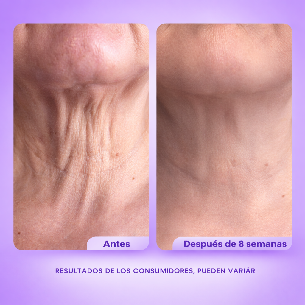 ESSOR® Sérum Reafirmante